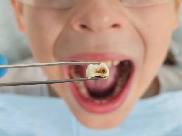 Best Emergency Treatment for Toothache in Gap, PA